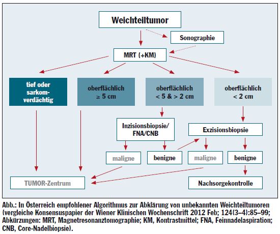 Weichteilsarkom oberschenkel symptome