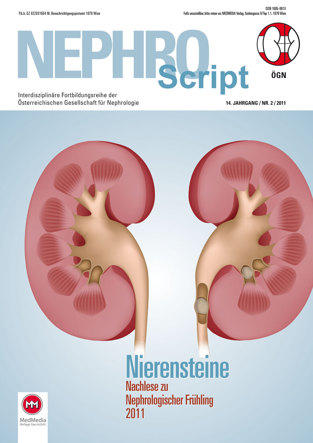 Diätmaßnahmen als primäre Metaphylaxemaßnahmen bei Nephrolithiasis | NEPHROScript