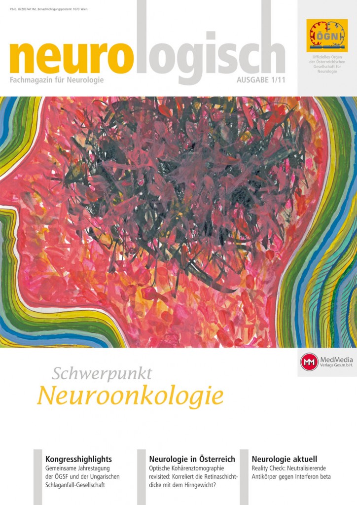 Neurotoxizität onkologischer Therapien neurologisch