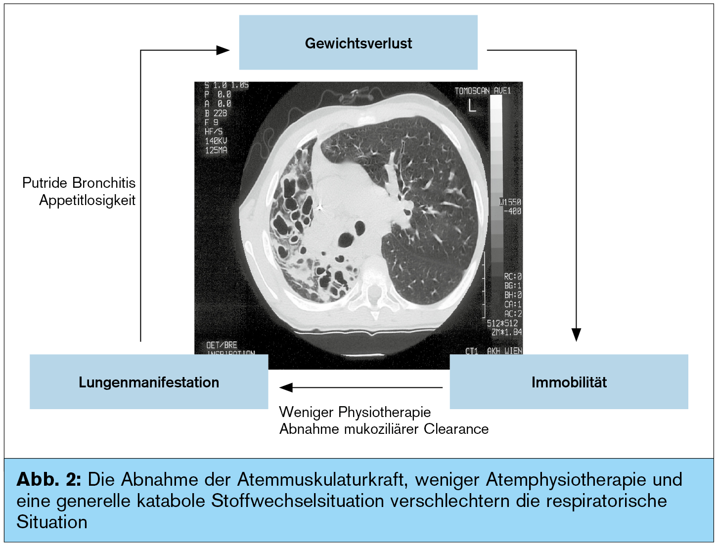 Die zystische Fibrose | Universum Innere Medizin | MedMedia