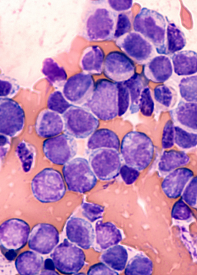 EHA 2019 | MedMedia