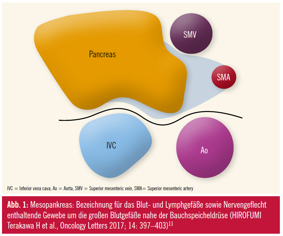 Therapie_Pankreaskarzinom_Abb_1 | MedMedia