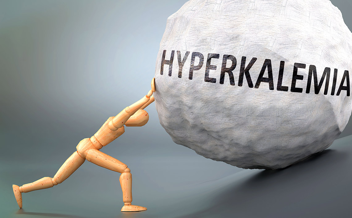 Hyperkaliämie – symptomlose Gefahr