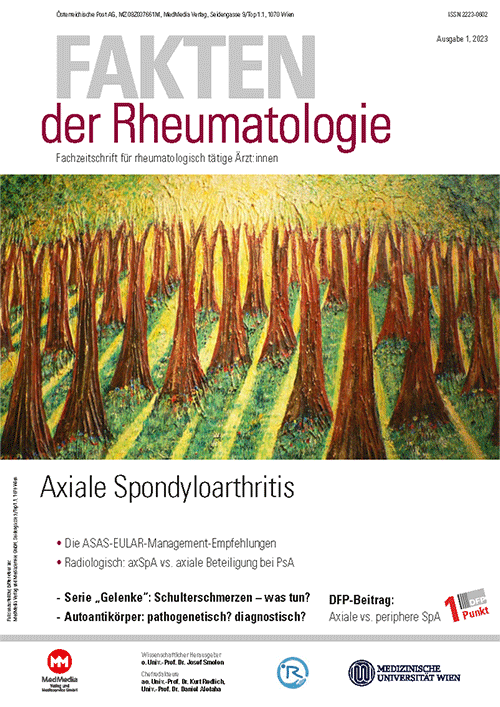 Mikrohämaturie Harmlos oder ernstzunehmendes Symptom? Ärzte Krone