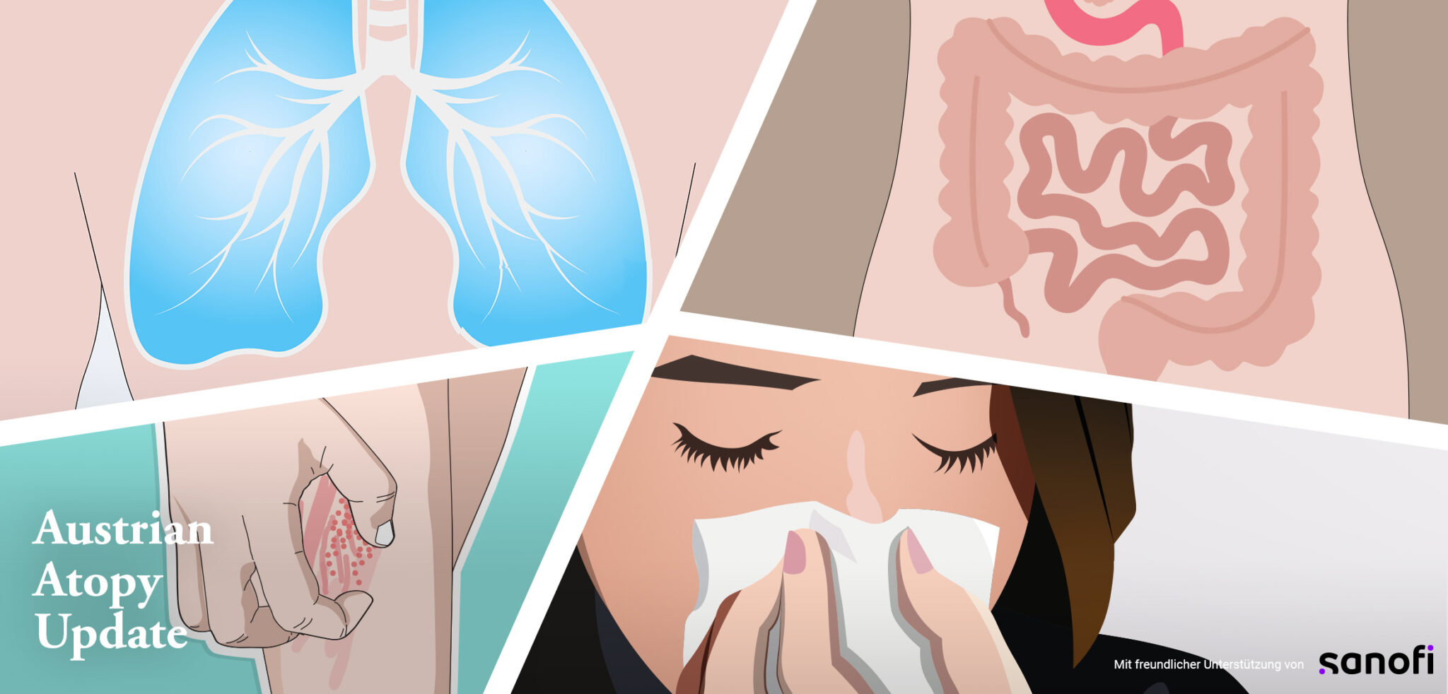Austrian Atopy Update | MedMedia