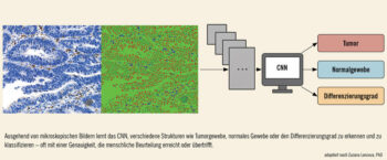 <strong>Abb.:</strong> Illustratives Beispiel, wie Convolutional Neural Networks (CNNs) genutzt werden, um histologische Gewebeproben zu analysieren.